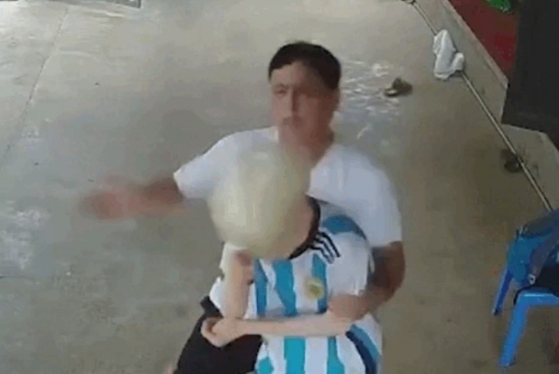 Giam dinh thuong tich be trai bi ong noi cua ban hanh hung hinh anh