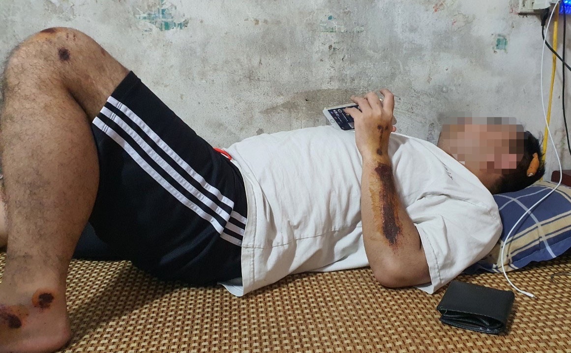 Bat giu 2 nghi pham vu ho 'chem chet' o Ha Noi hinh anh