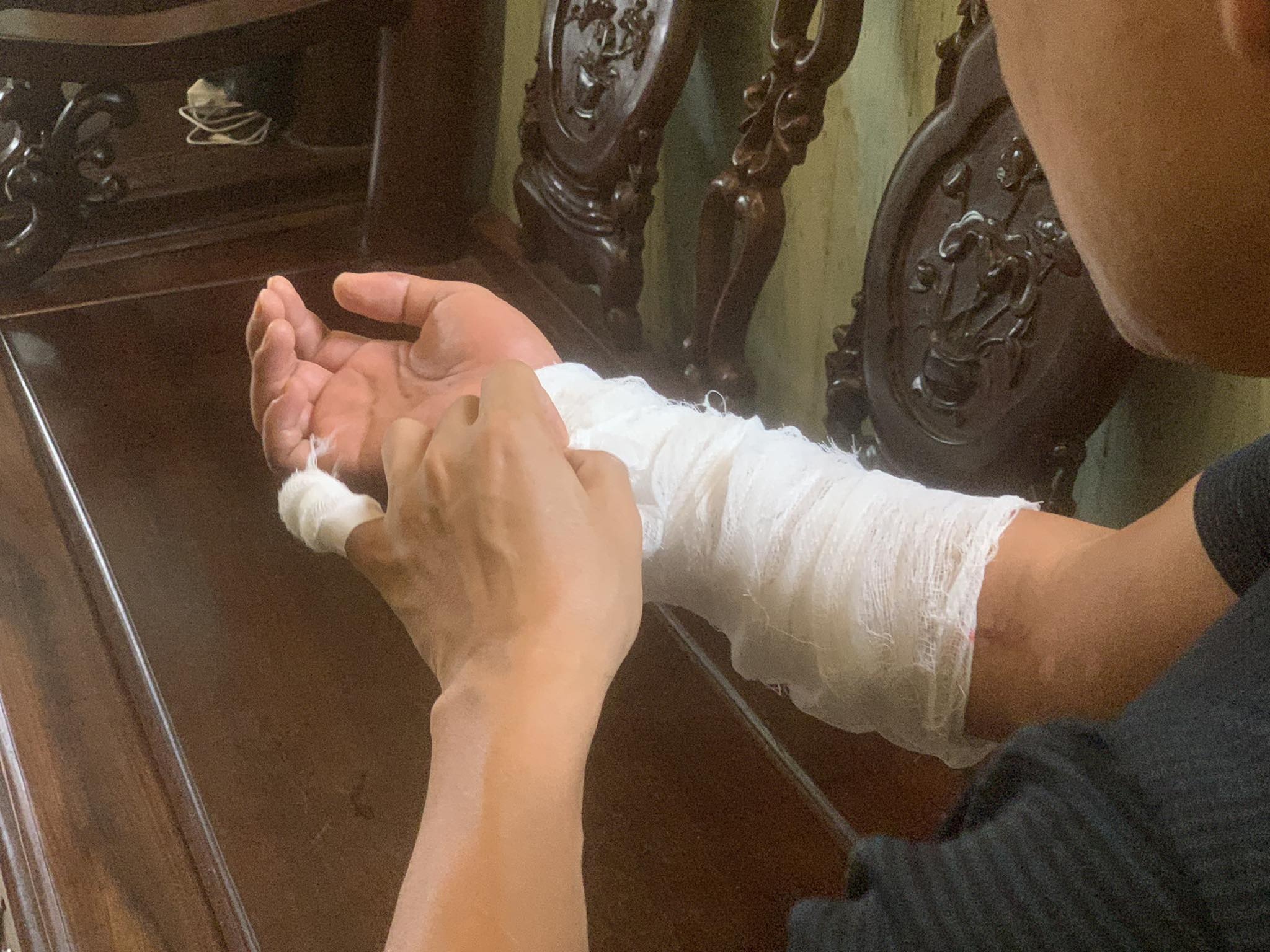 Khoi to vu nguoi dan ong bi chem lia tay o Ha Noi hinh anh