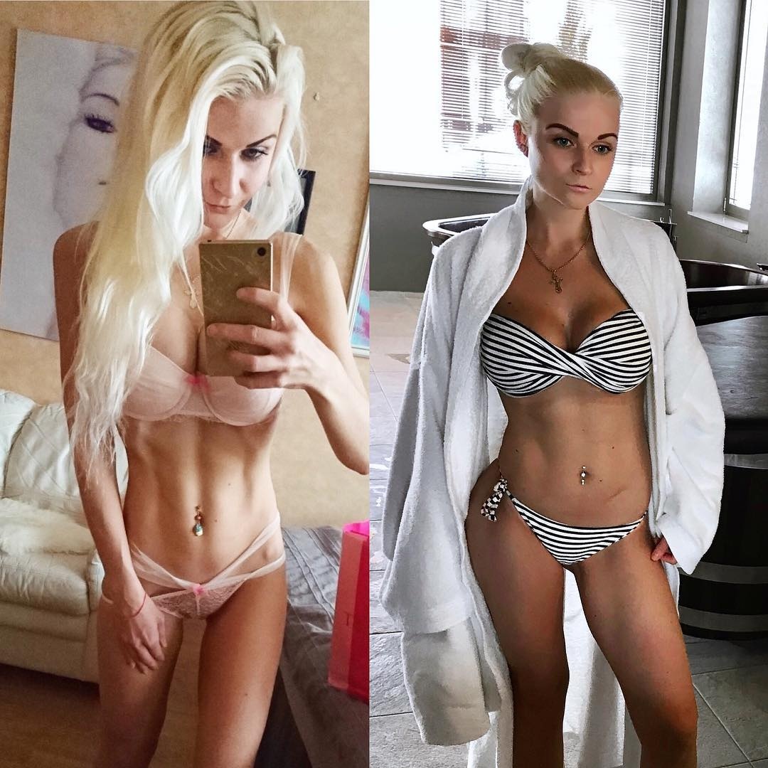 bệnh chán ăn ảnh 4 benh chan an anh 4