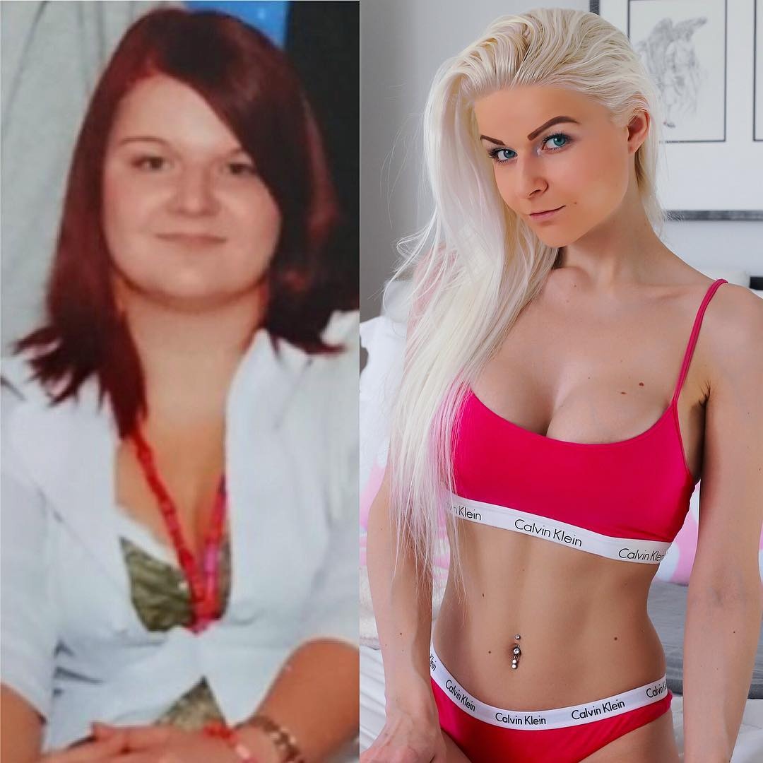 bệnh chán ăn ảnh 2 benh chan an anh 2