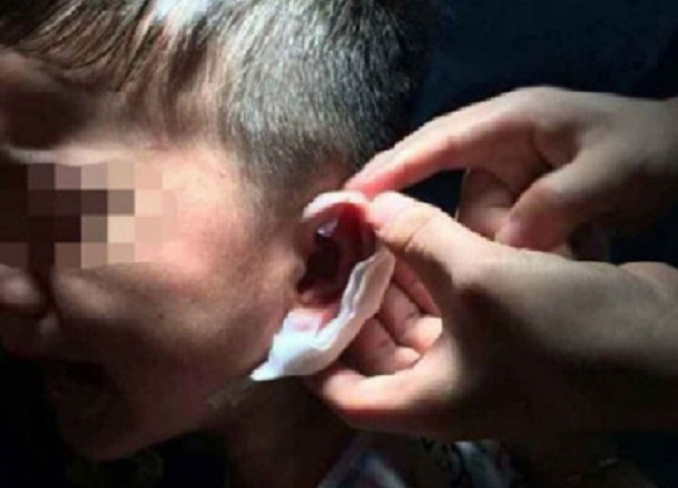 Giao vien mam non Trung Quoc dap ghim sach vao tai tre hinh anh