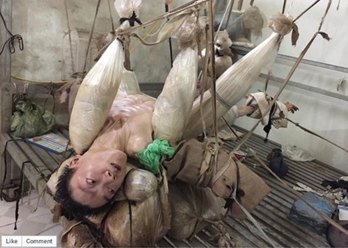 Anh nguoi dan ong bi treo tay, chan khien trieu nguoi roi le hinh anh