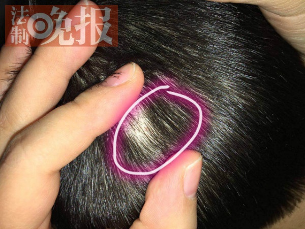 Trung Quoc dieu tra 5 co giao mam non dung kim dam tre hinh anh