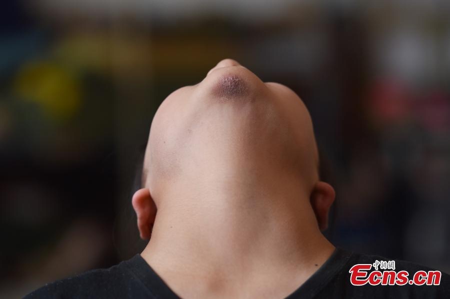 truong day uon deo anh 5