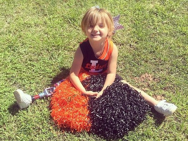 Nghi luc cua co be 3 tuoi bi khuyet tat hinh anh