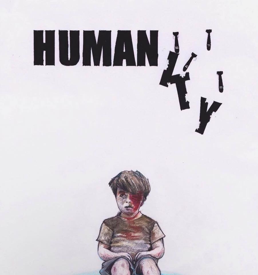 Cau be Syria bi thuong anh 3