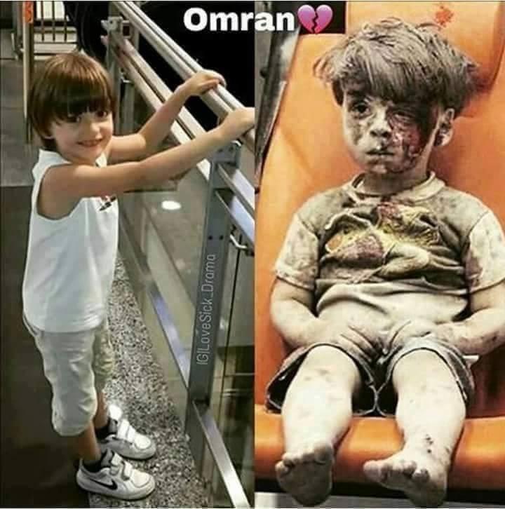 Cau be Syria bi thuong anh 4