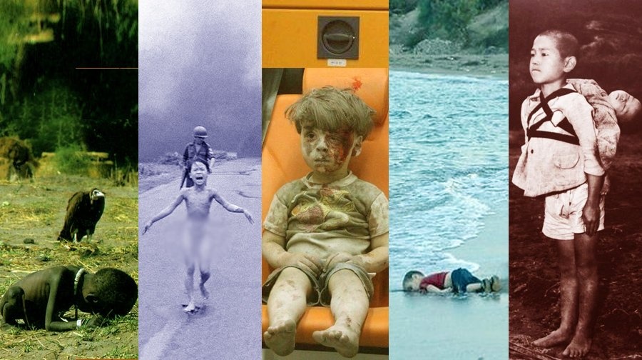 Cau be Syria bi thuong anh 7