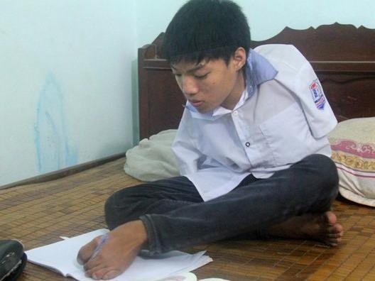 Chang trai cut hai tay vao dai hoc hinh anh