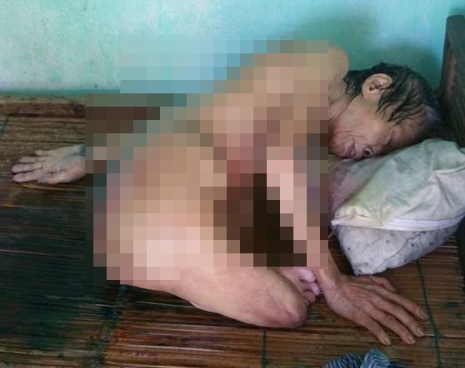 cụ bà mù cụt chân thoi thóp ảnh 1 cu ba mu cut chan thoi thop anh 1