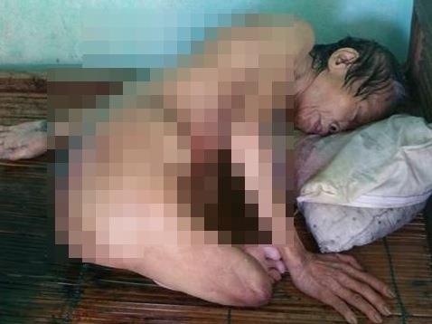 Cu ba mu cut chan o Quang Nam duoc ung ho 197 trieu dong hinh anh