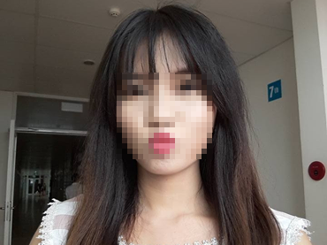 Co gai xinh dep bi bong toan than, mat bien dang sau tai nan hinh anh