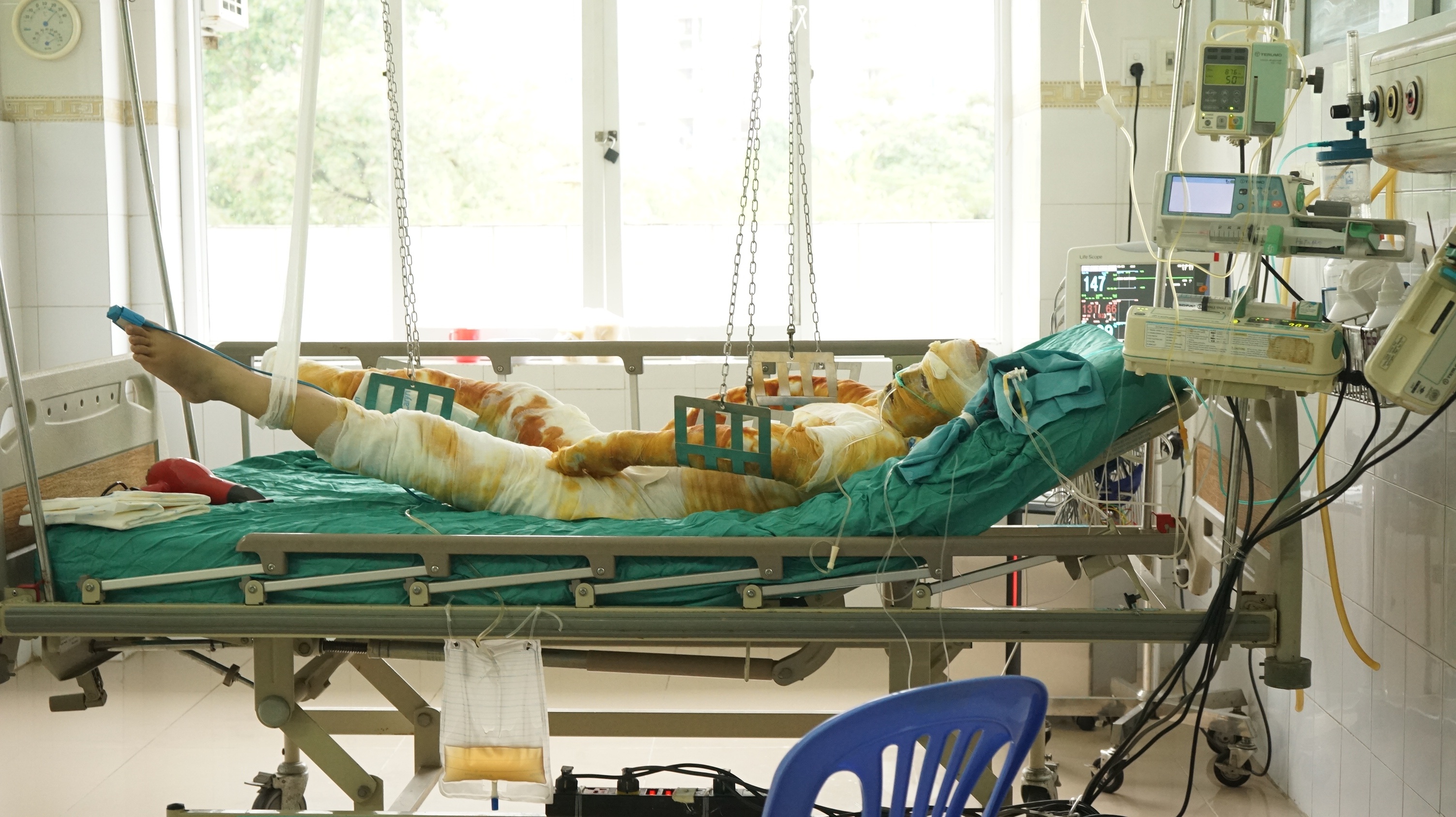 co gai bong xang sau va cham giao thong anh 1