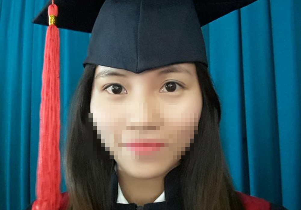 Noi dau tot cung cua co gai bi bong toan than, mat bien dang hinh anh