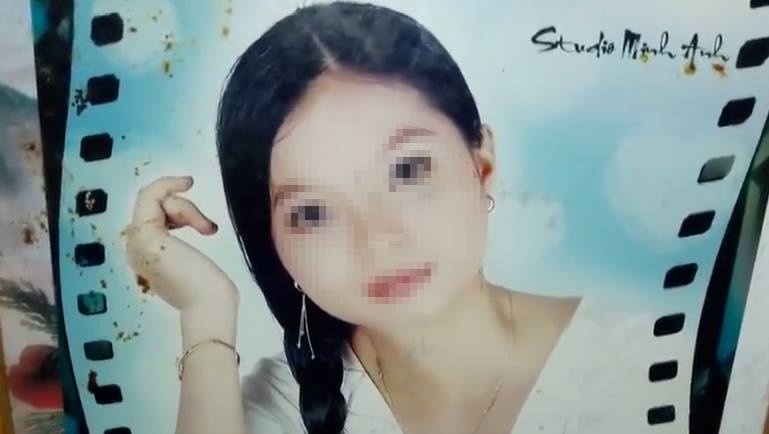 Co gai nhieu lan tu van vi nua khuon mat bi an mon hinh anh