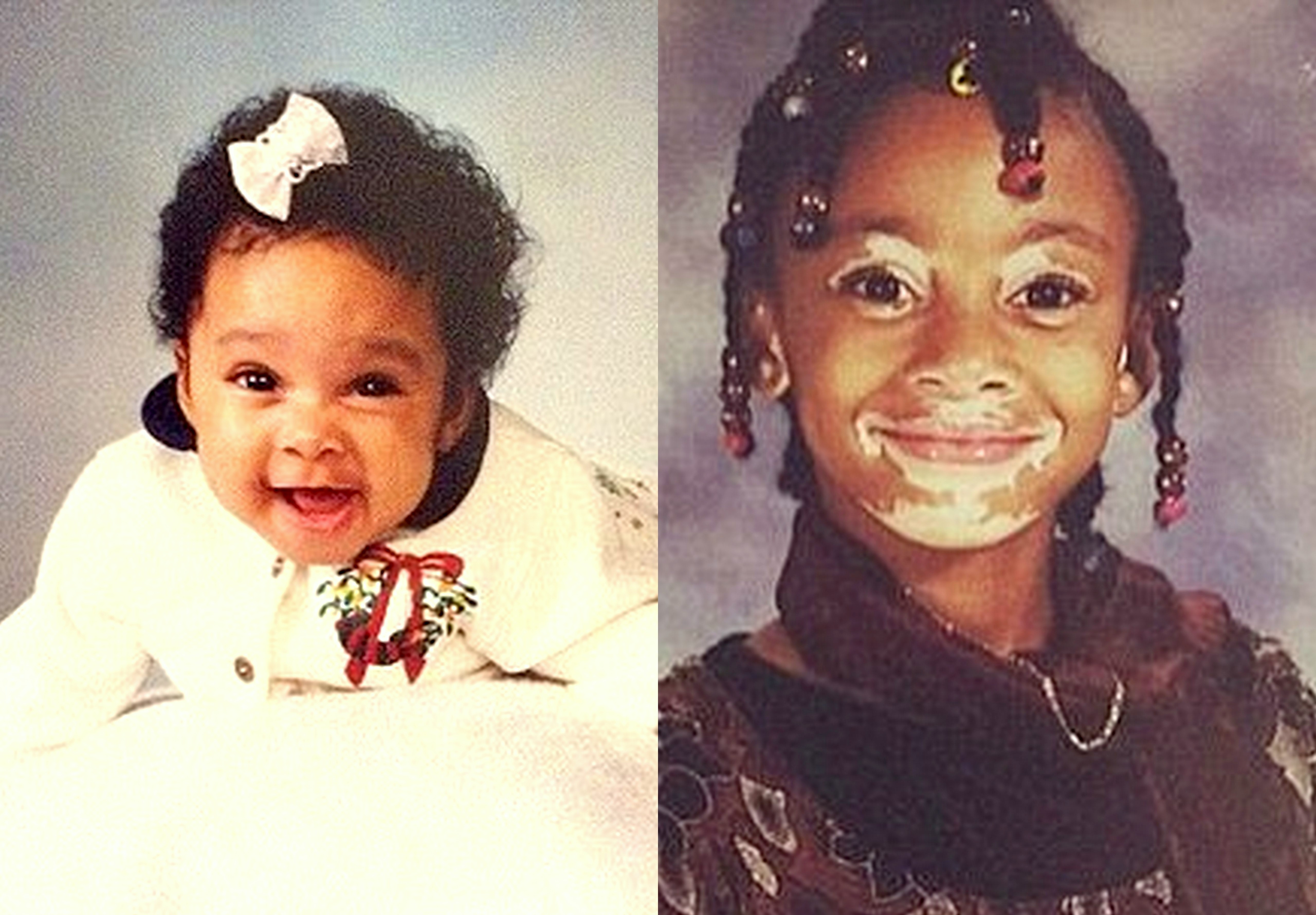 người mẫu da loang lổ ảnh 1 nguoi mau da loang lo anh 1