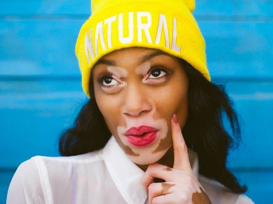 Nguoi mau 9X noi tieng the gioi nho lan da loang lo hinh anh