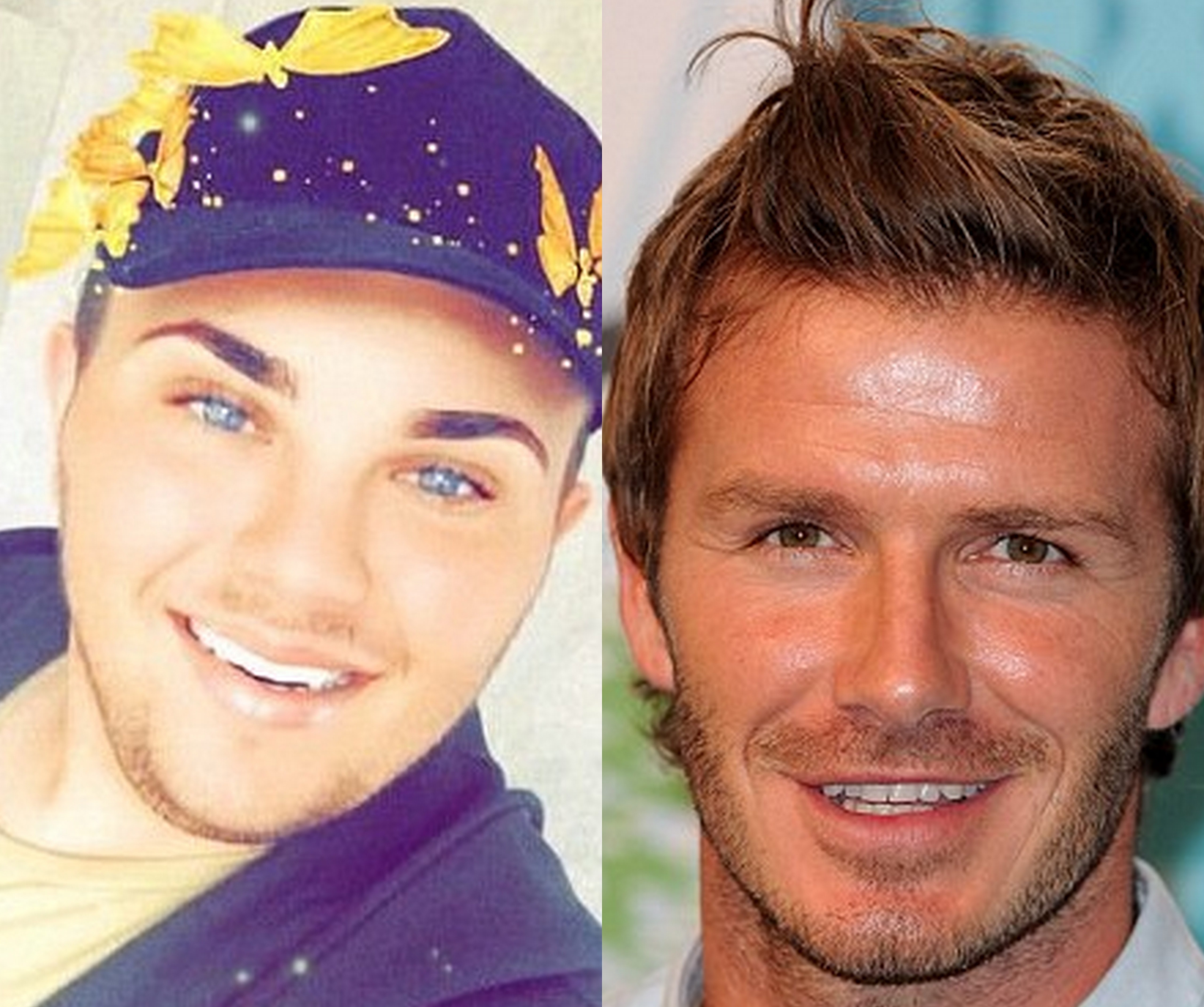 9X no luc phau thuat giong Beckham de noi tieng hinh anh