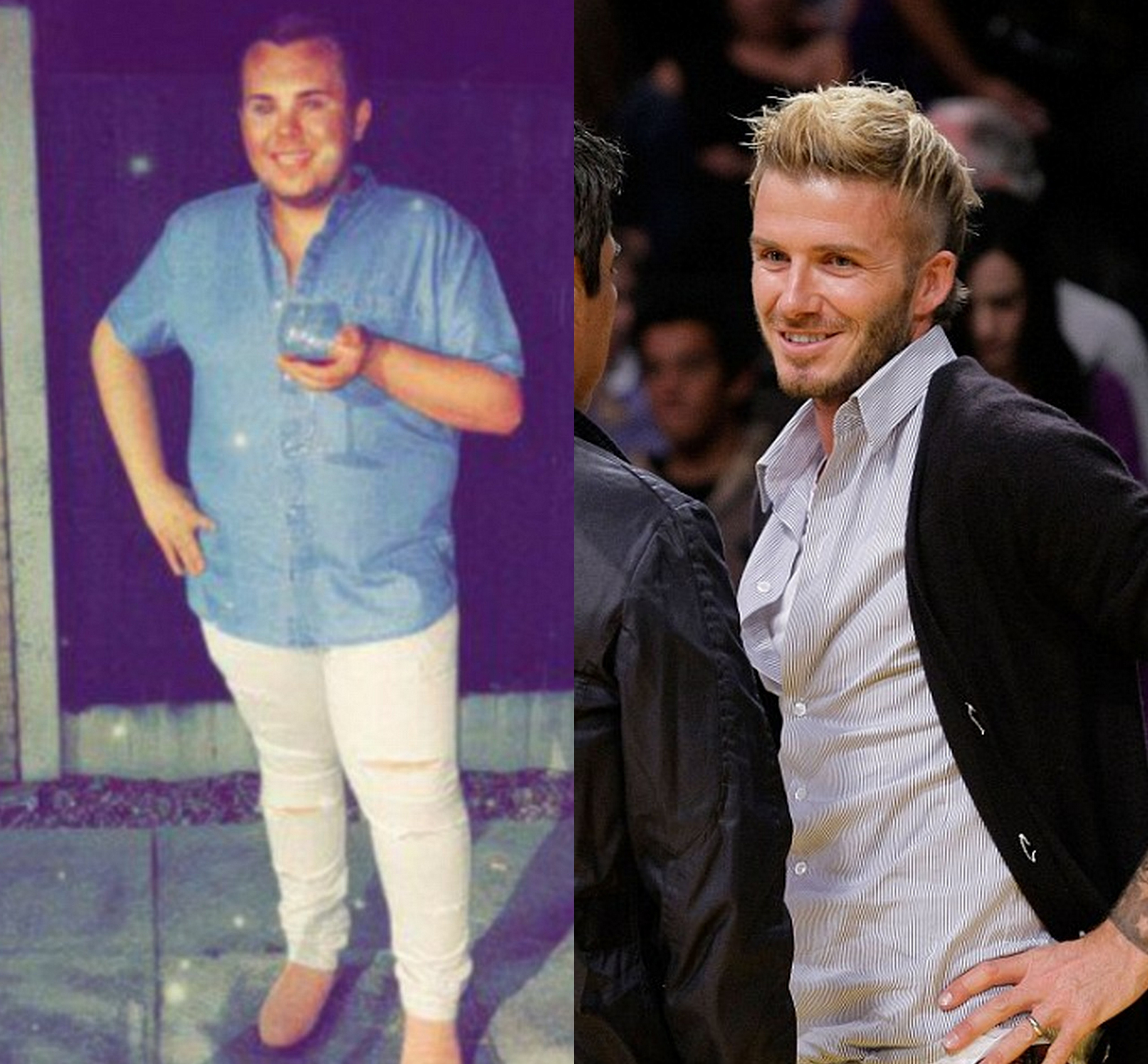 chang trai phau thuat giong David Beckham anh 2