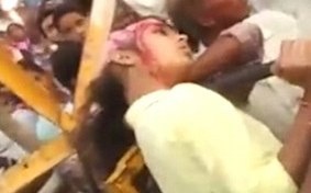 Nu sinh mat gan het toc vi mai chup selfie hinh anh