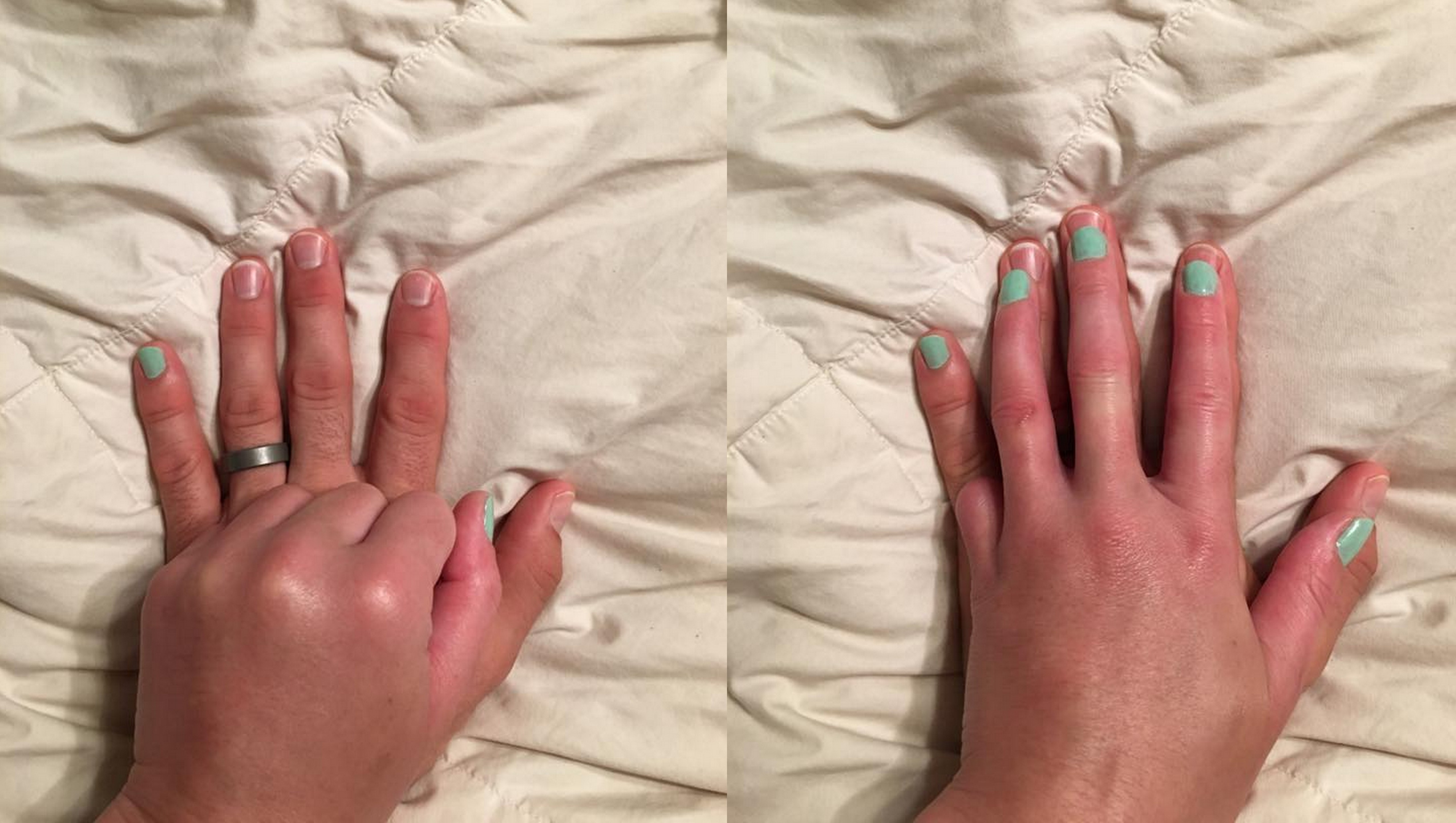 cau chuyen tinh yeu anh 2