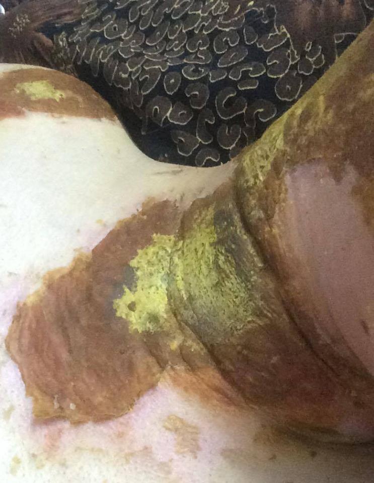 Nữ sinh Phan Đình Phùng bỏng nặng  ảnh 1 Nu sinh Phan Dinh Phung bong nang anh 1