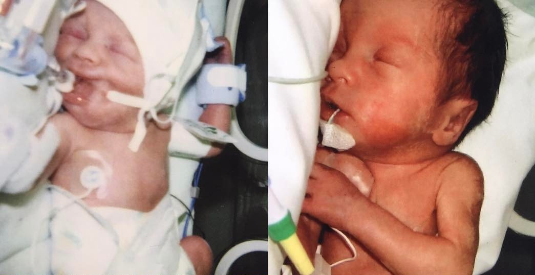 người mẫu nhí nẹp chân ảnh 1 nguoi mau nhi nep chan anh 1