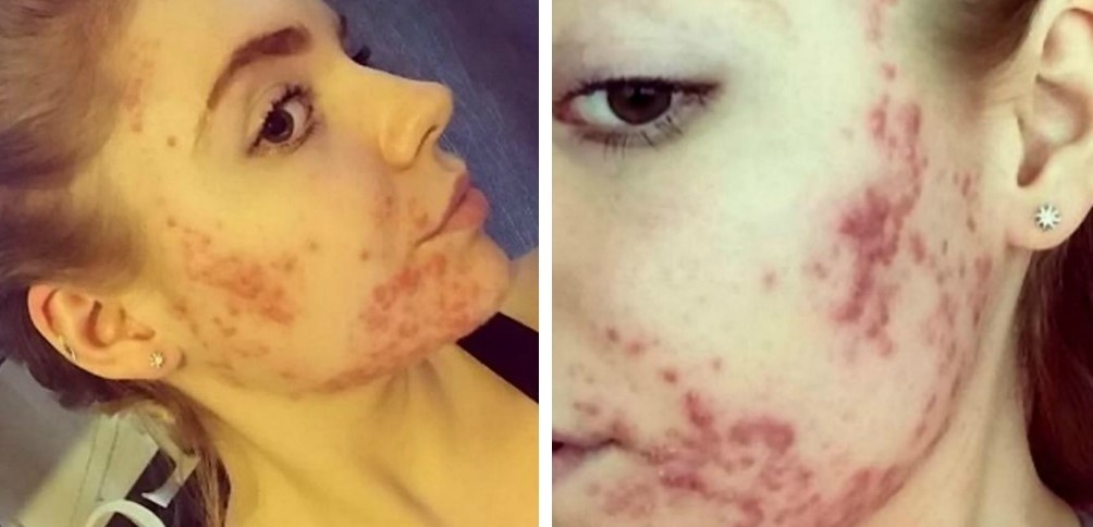 cô gái đăng ảnh mặt mộc ảnh 2 co gai dang anh mat moc anh 2