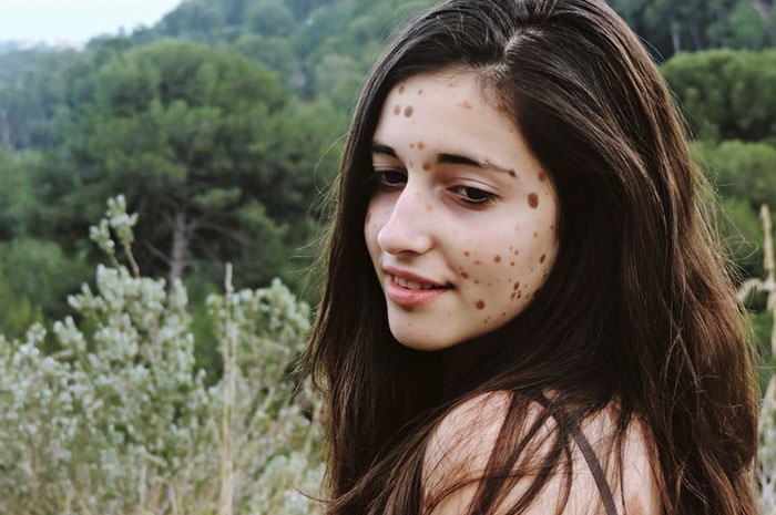 co gai co lan da loang lo anh 5