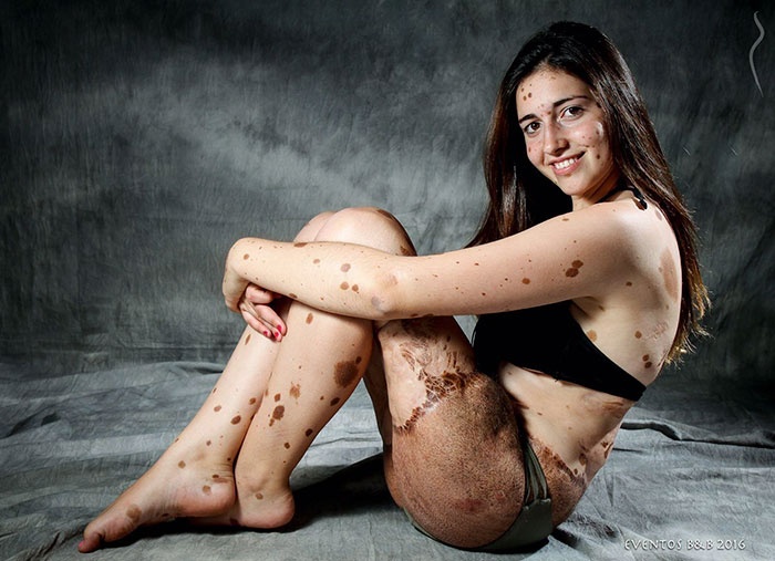 co gai co lan da loang lo anh 1