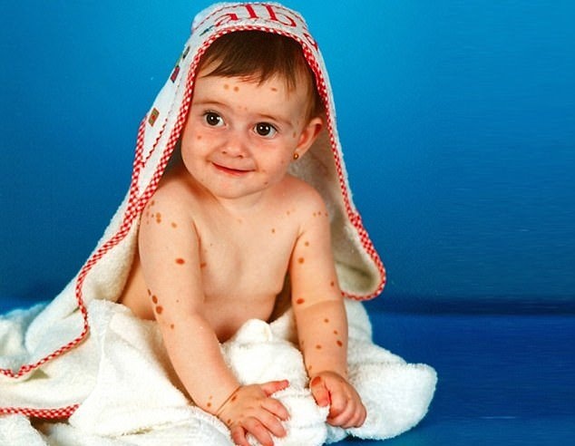 co gai co lan da loang lo anh 4