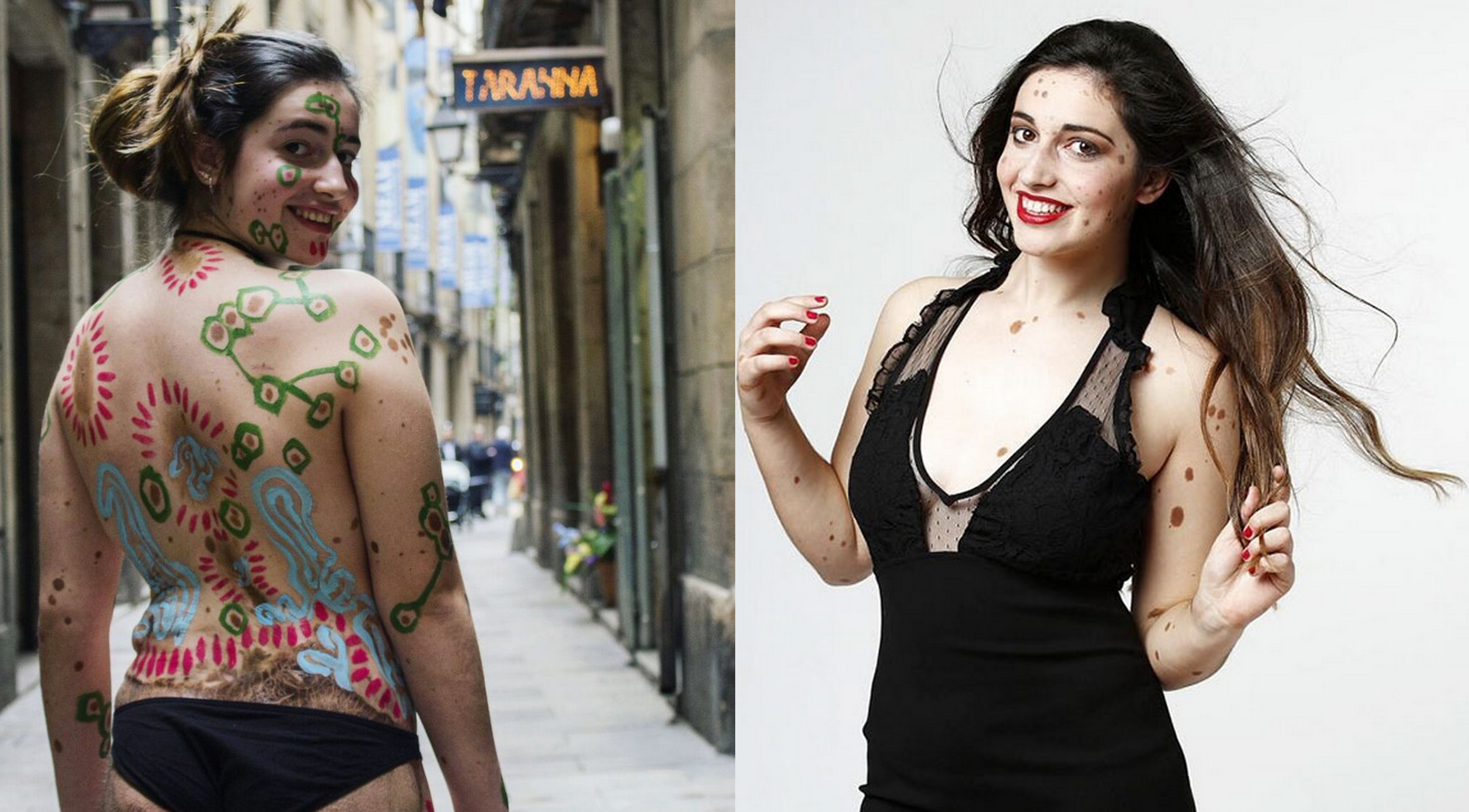 co gai co lan da loang lo anh 2