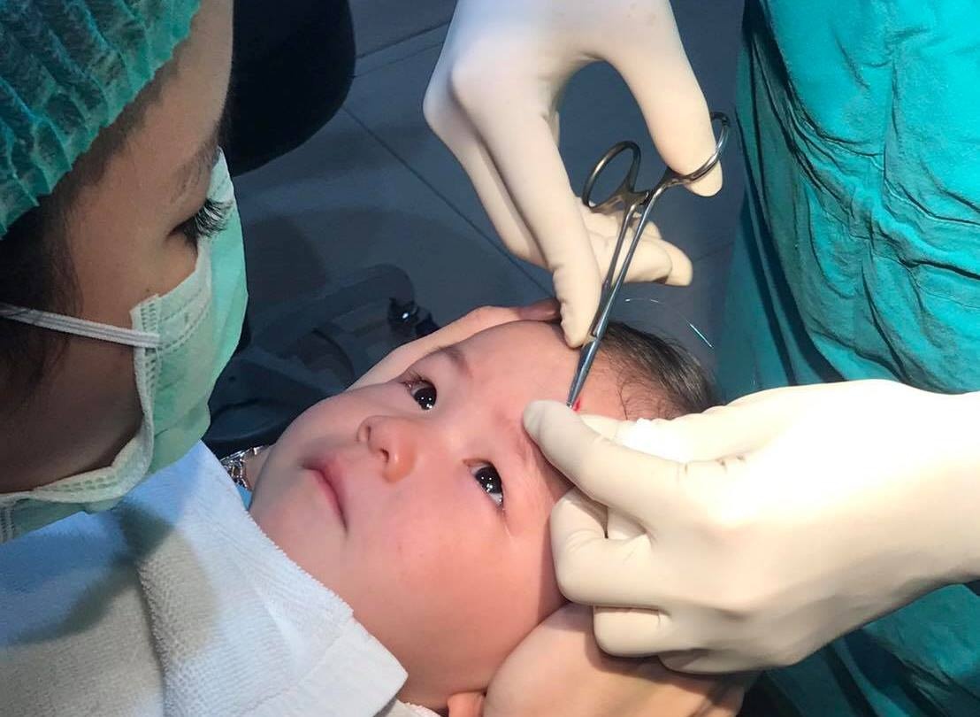 cô bé không khóc khi được khâu ảnh 1 co be khong khoc khi duoc khau anh 1