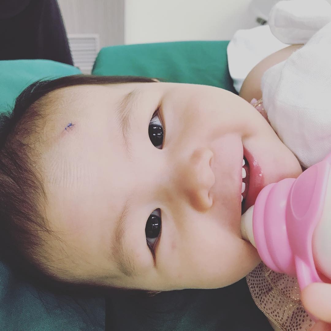 Anya sau khi duoc bac si khau tran hinh anh