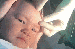 Be gai quyet khong khoc khi duoc bac si khau vet thuong hinh anh