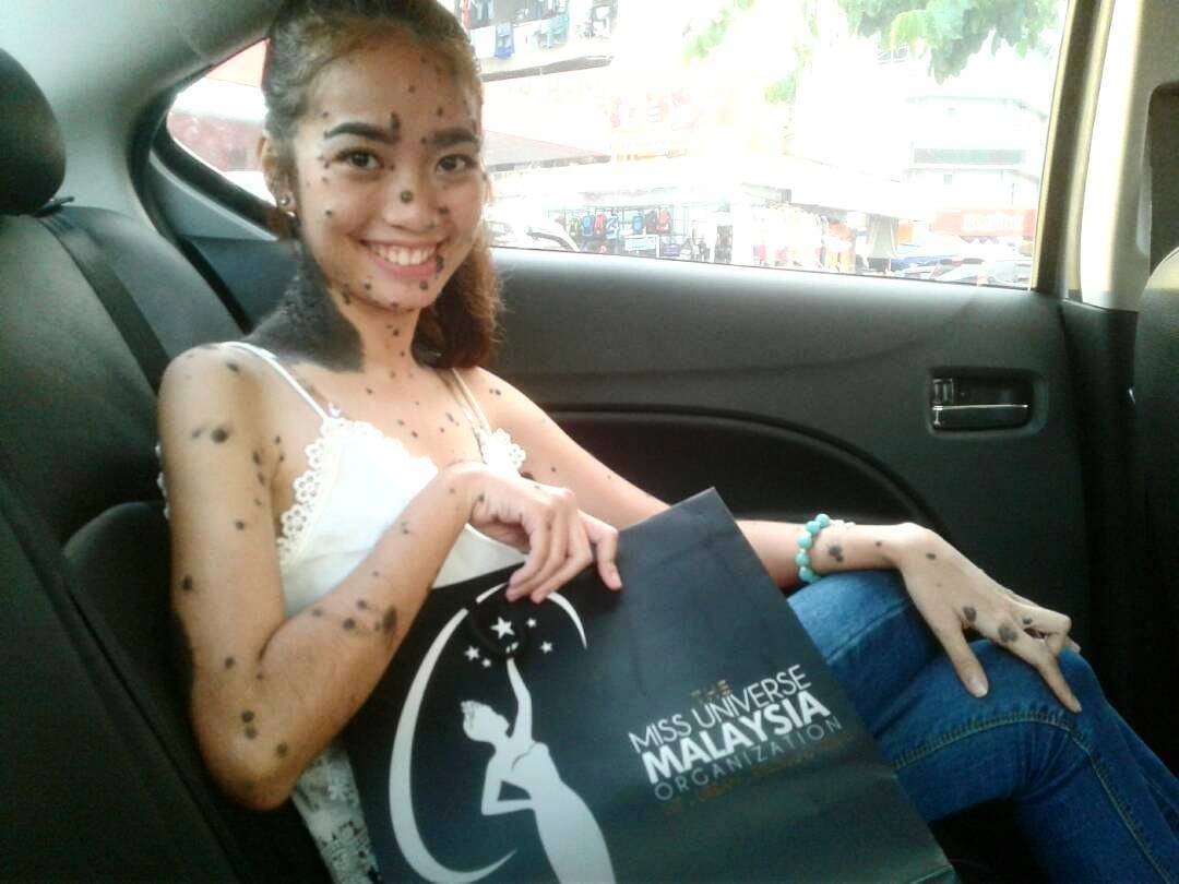 co gai nhieu not ruoi thi hoa hau anh 3