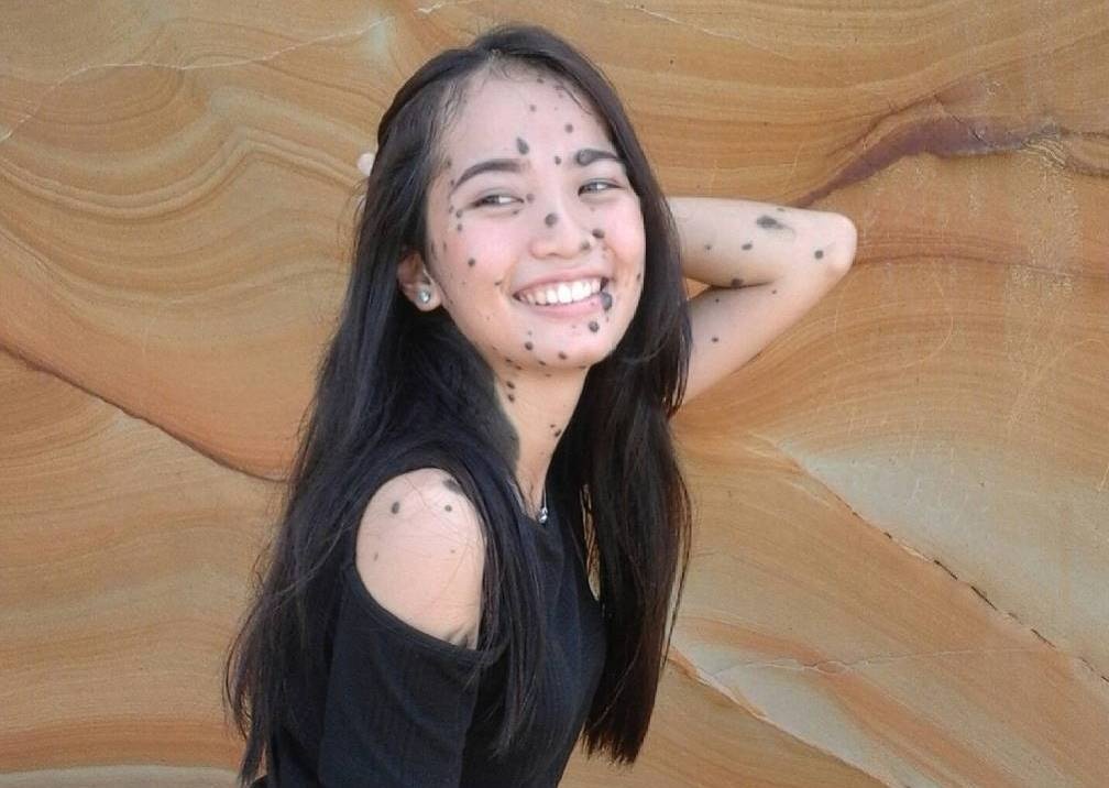 co gai nhieu not ruoi thi hoa hau anh 4