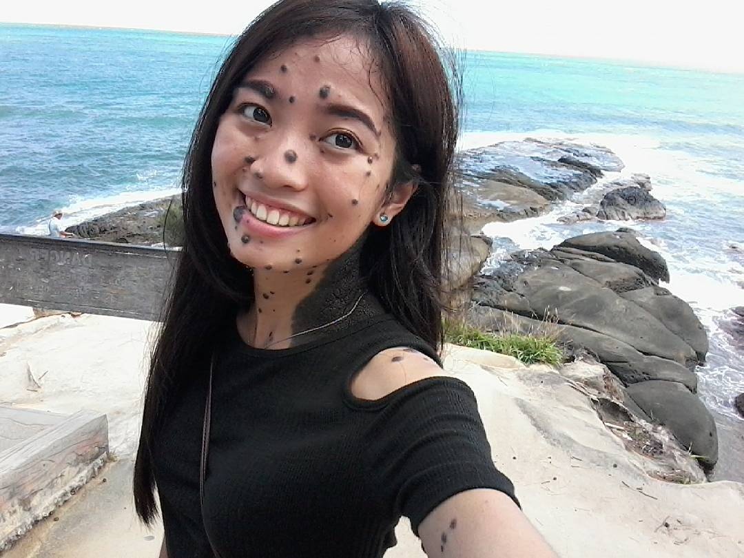 co gai nhieu not ruoi thi hoa hau anh 1