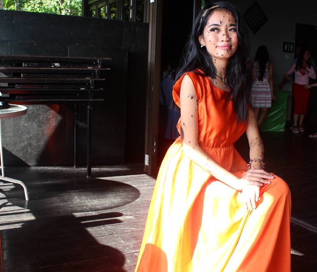 co gai nhieu not ruoi thi hoa hau anh 5