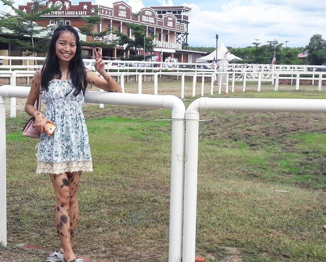 co gai nhieu not ruoi thi hoa hau anh 6