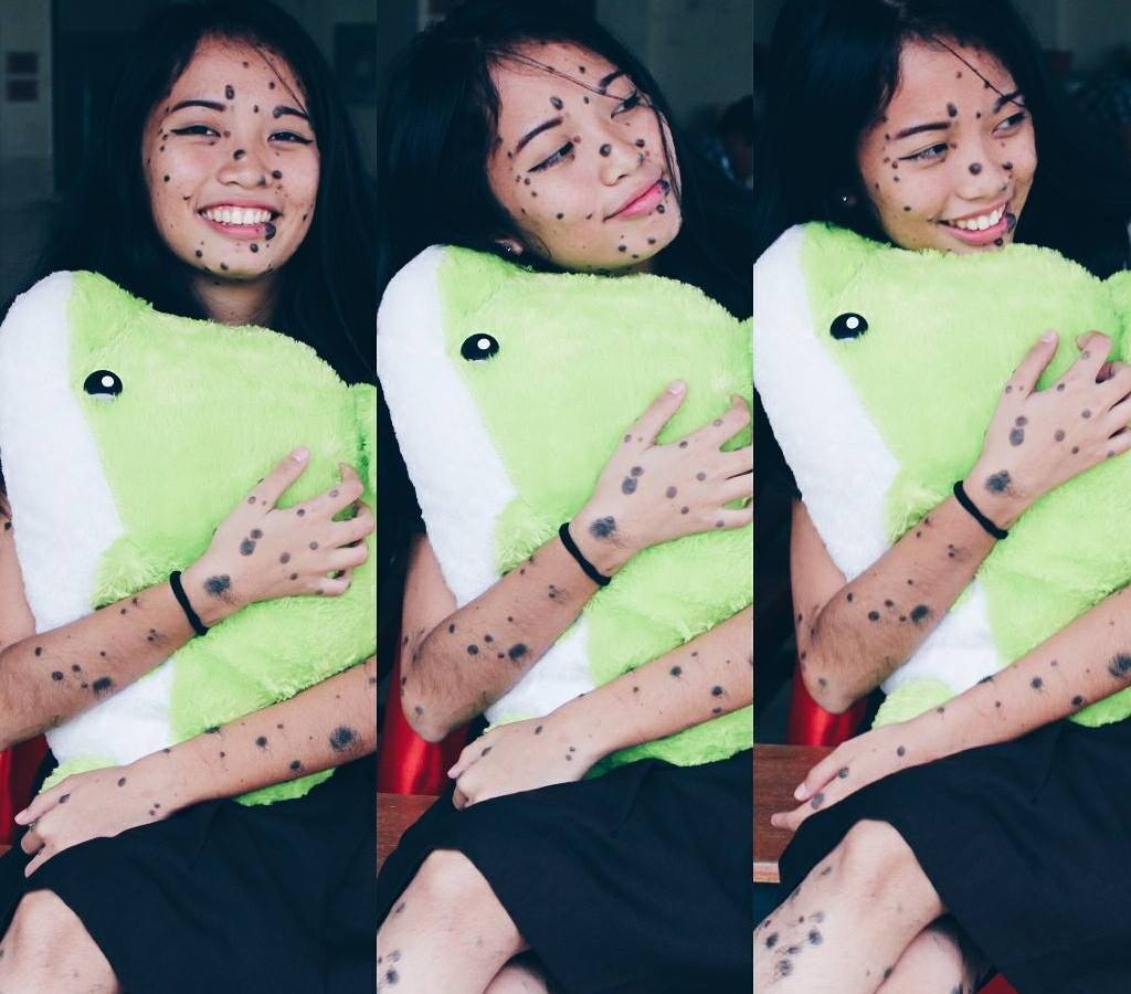 co gai nhieu not ruoi thi hoa hau anh 7