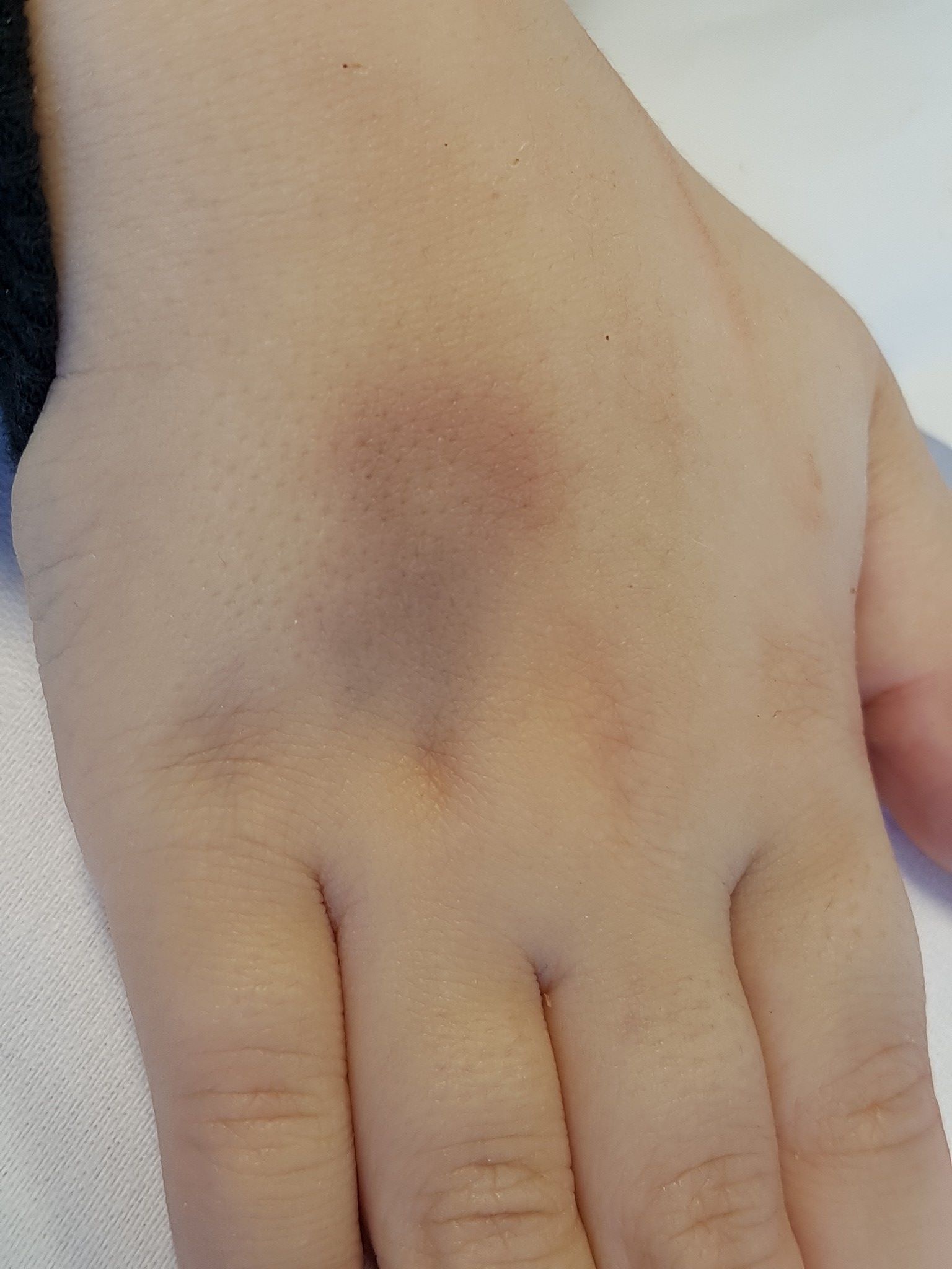 cô bé làm đám cưới trước khi mất ảnh 9 co be lam dam cuoi truoc khi mat anh 9