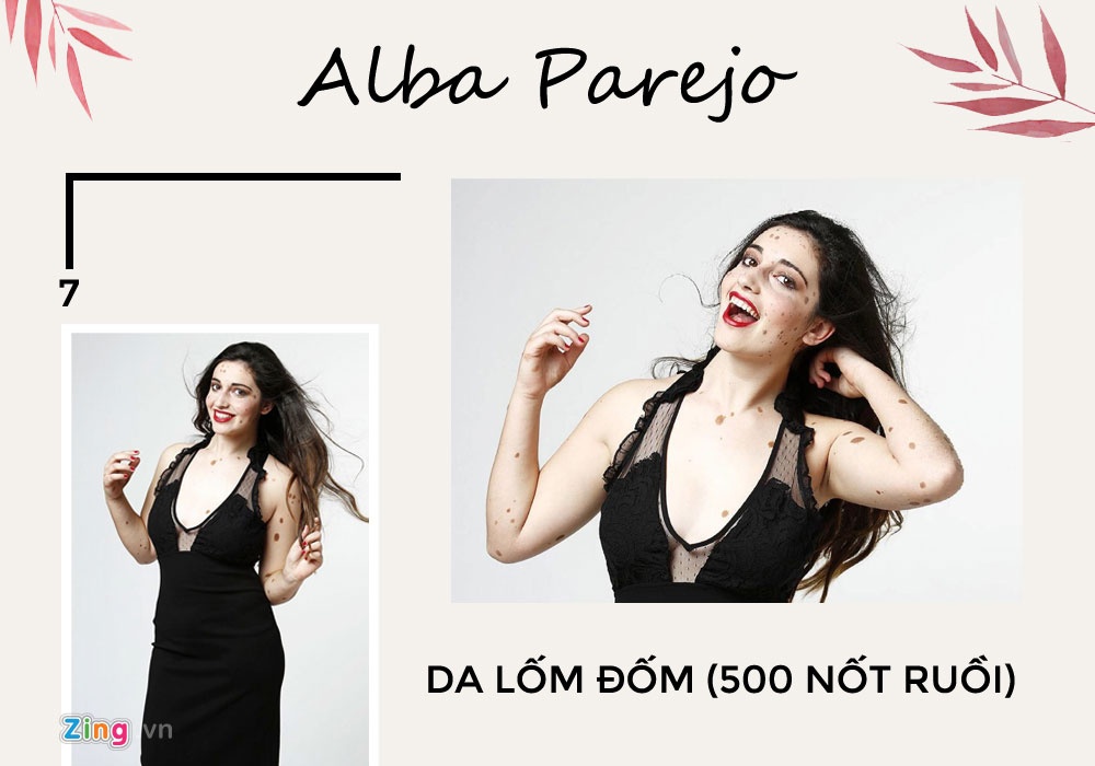 ve dep khong co gioi han anh 7