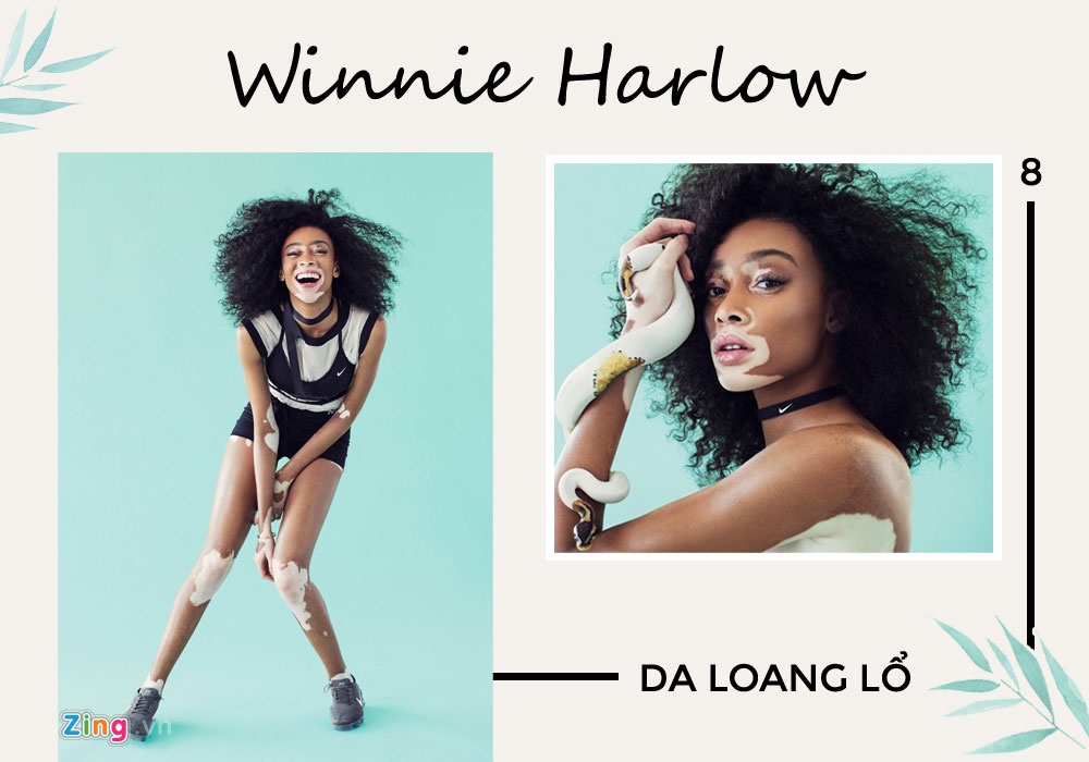 ve dep khong co gioi han anh 8