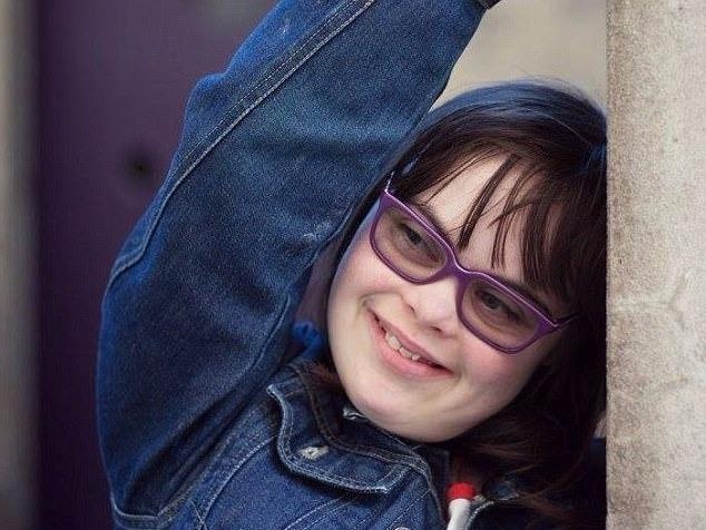 Tu co be bi benh Down tro thanh dien gia noi tieng hinh anh