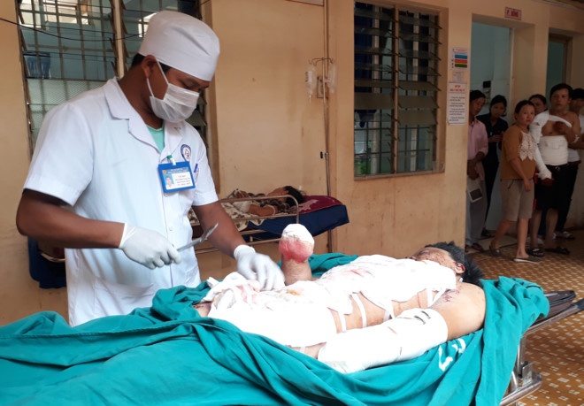 mat hai tay khi lac phan bon anh 1