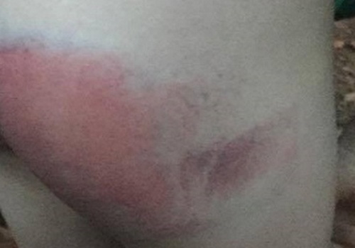 Co giao dung thuoc danh tim mong hoc sinh hinh anh