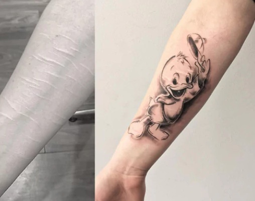 Nhung tuyet tac tu hinh xam che vet seo hinh anh