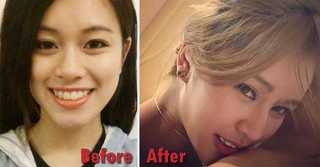 cô gái phẫu thuật thẩm mỹ hơn 30 lần ảnh 2 co gai phau thuat tham my hon 30 lan anh 2